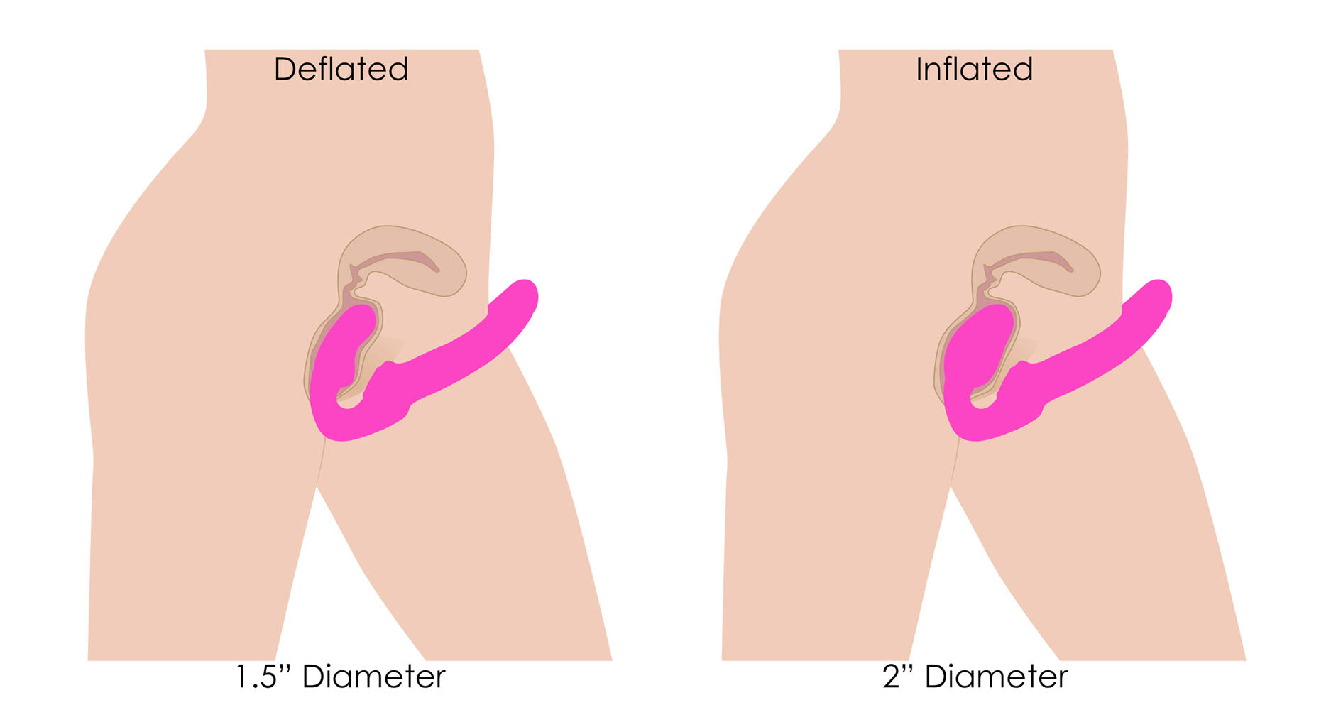 Worlds First Remote Control Inflatable Ergo-Fit Strapless Strap-On – Remote-Controlled Strapless Strap-On > Dildos > Strapless Strap Ons
